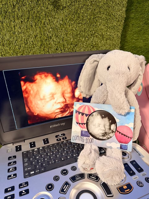 White plush elephant toy sitting on retro Mindray computer with fiery image displayed on screen